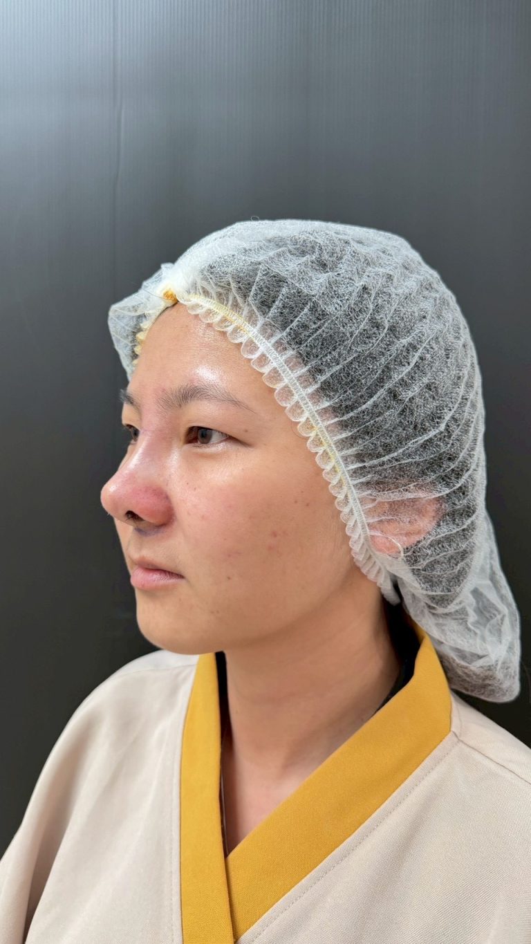 เสริมจมูกใกล้ฉัน เลือกอย่างไรให้ปลอดภัย ได้ทรงสวยถูกใจ และคุ้มค่ากับการลงทุน